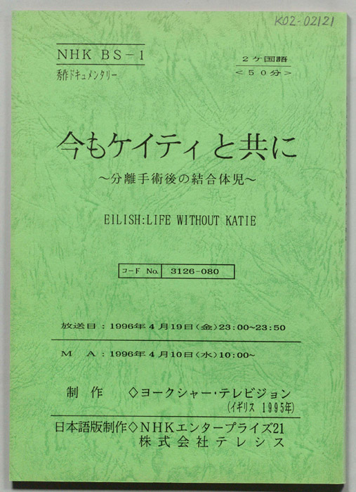 今もケイティと共に　～分離手術後の結合体児～